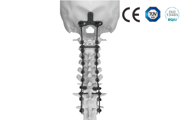 颈椎后路内固定系统