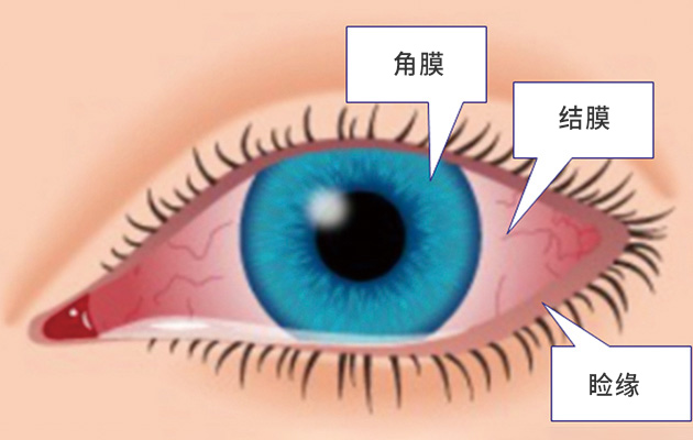 眼表角膜专科