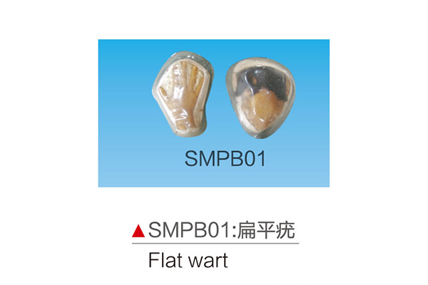 SMPB01 Flat wart