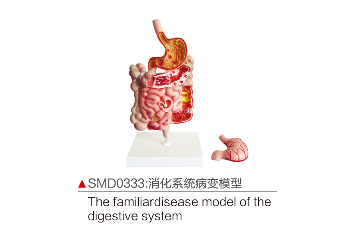 SMD0333：消化系统病变模型