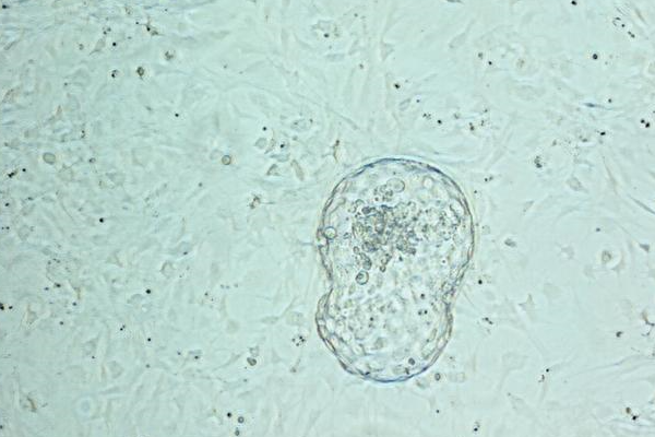 胚胎的等级是怎们划分的？