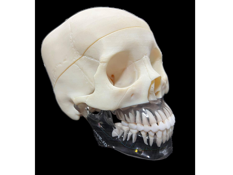 颌面解剖结构个体化重构