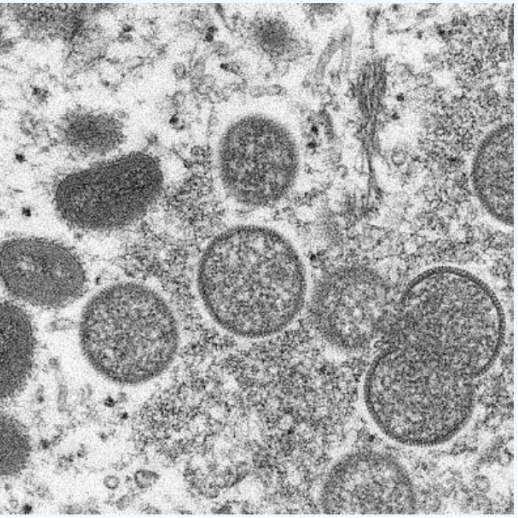 猴痘疫情席卷12国 js333金沙线路检测核酸快速检测在行动