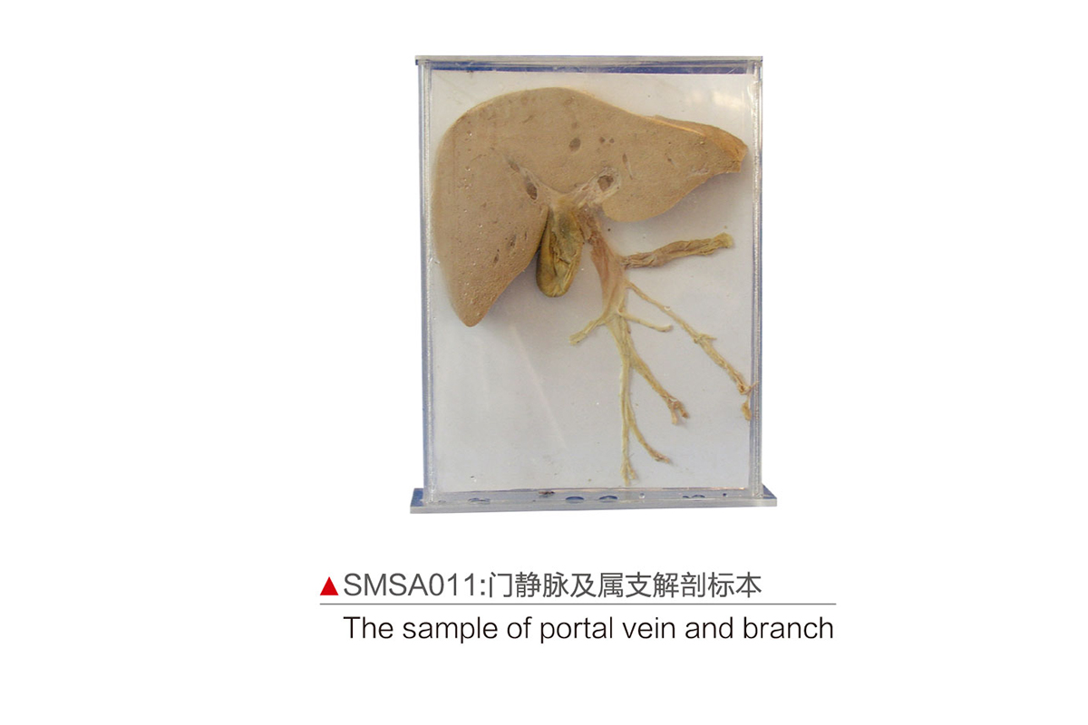 SMSA011：门静脉及属支解剖标本