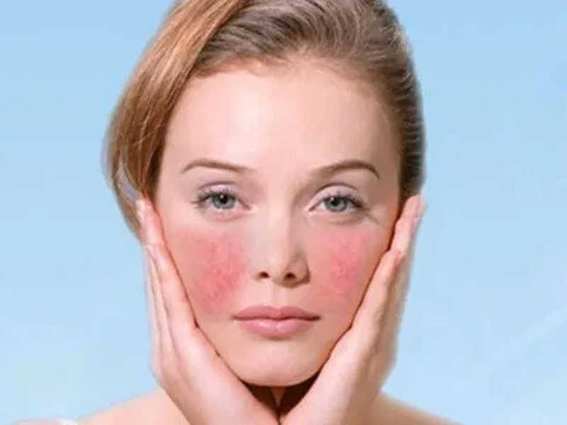 How to win the sensitive skin market that is growing year by year?