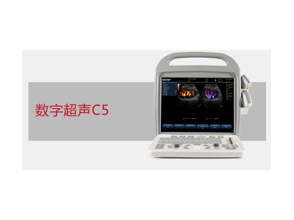C5 portable color ultrasound system