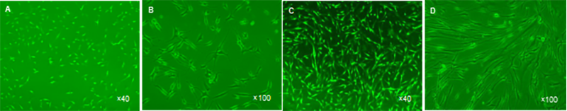 Ⅱ型胶原蛋白对人软骨细胞生物学特性的影响