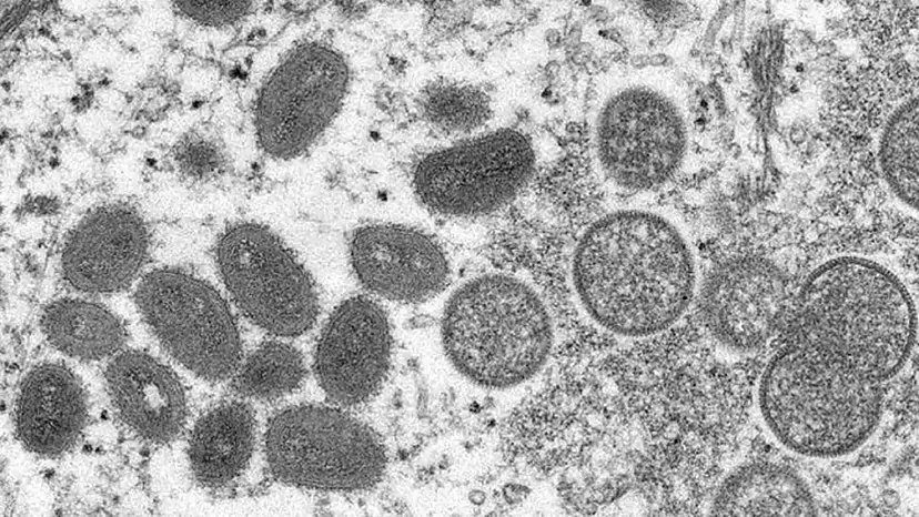 迎战猴痘病，美格生物助力病毒核酸检测试剂开发