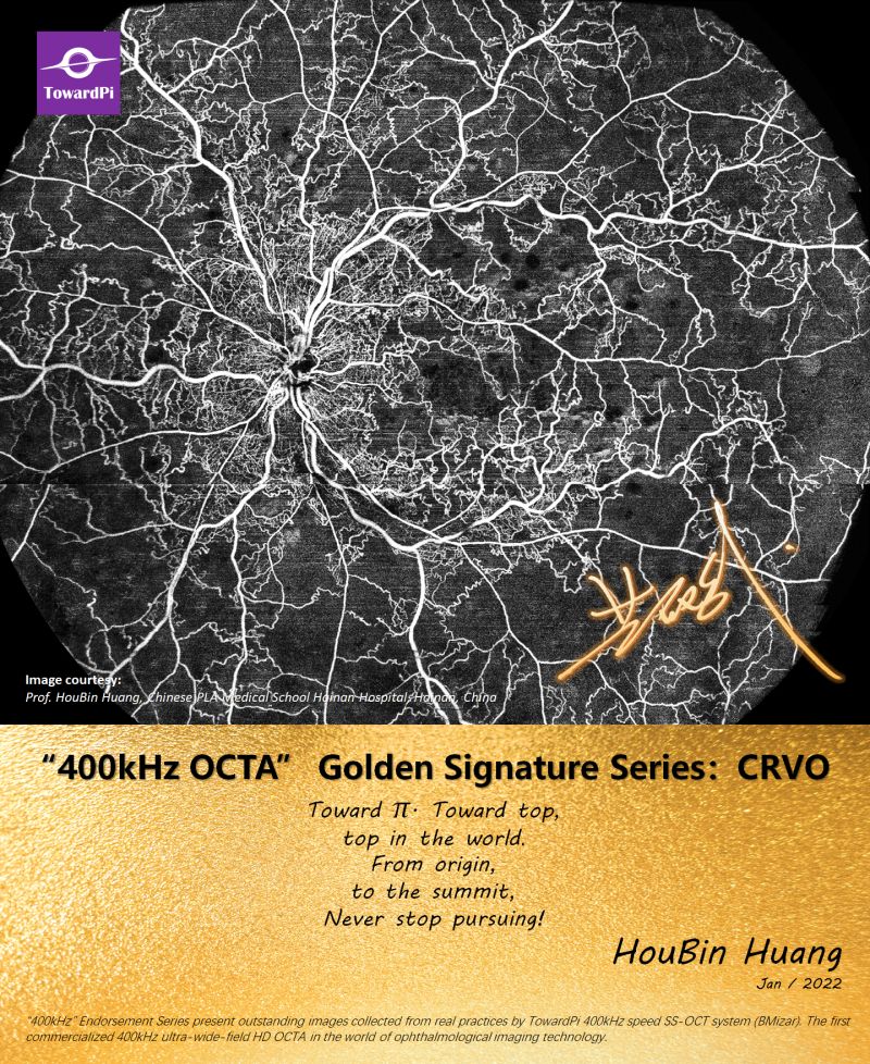Central Retinal Vein Occlusion, OCTA Single Scan
