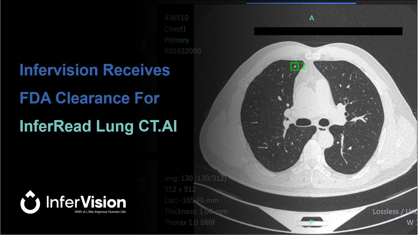 Infervision Receives FDA Clearance for the InferRead Lung CT.AI