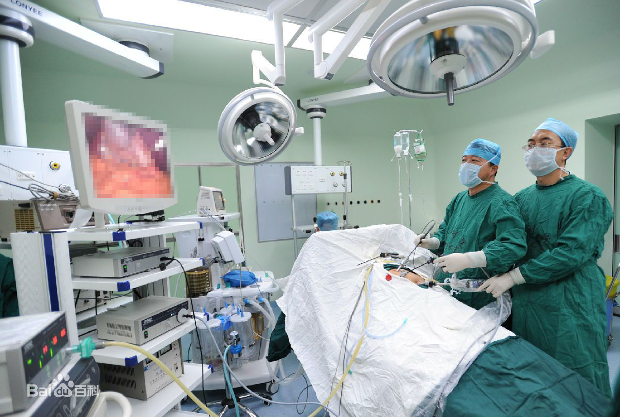 手术医师通过监视腔镜切割供应商屏幕检查盆